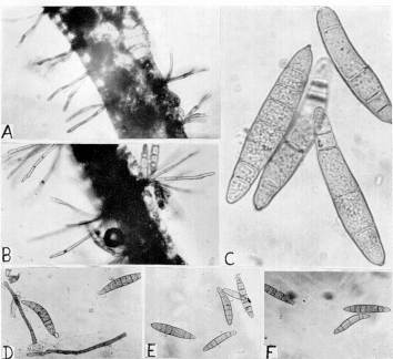 Fig. 4. Microfotografas de Helminthosporium turcicum. A y B: conidiforos; C-F=conidios (c= 400 x; las restantes= 100 x ).