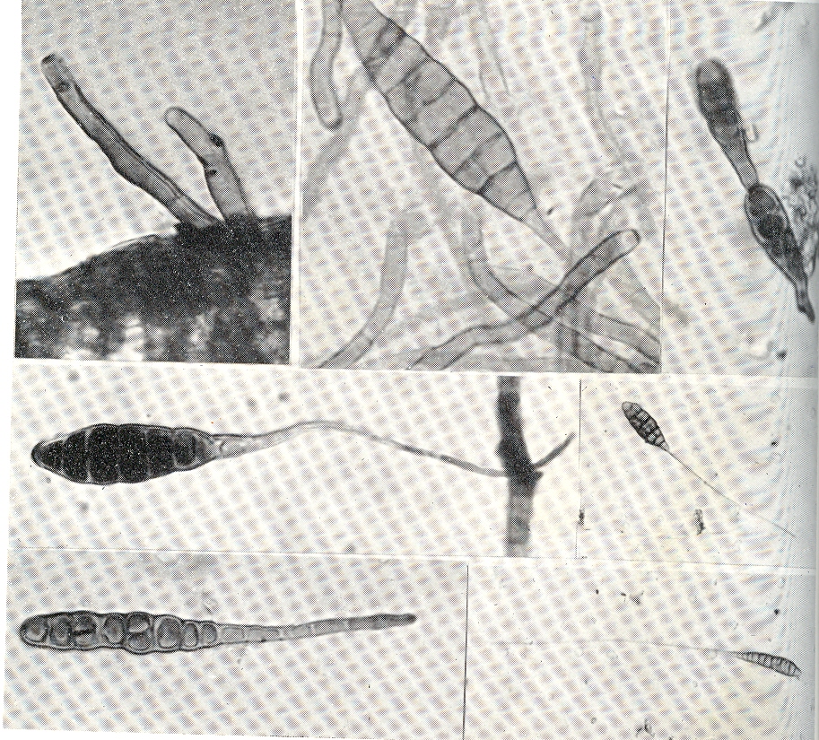Fig. 3. Alternara sesamcola: conidiforos y conidios. Ntase el diferente largo de los rostros apicales y tamao de los conidios. (x 100 las dos fotos del centro, y abajo der.: las dems x 400). 