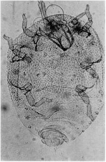 Fig 10. Viteus vitifoliae (Fitch).