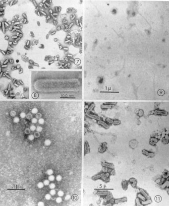 Fig. 2. Enfermedades del maz causadas por virus.( 7 ) Partculas del VMM ( enanismo rayado del maz ) procedentes de una purificacin. Se observan varias partculas en el proceso de rompimiento debido a la inestabilidad de las mismas "in vitro".(8) Detalle del VMM; la partcula presenta una morfologa baciliforme (rhabdovirus). El tamao de la misma es aproximadamente 250 x 50 nm. Se puede observar una parte central ms densa, una estructura espiralada en el interior y la membrana externa. (9) Partculas del VMC aisladas de plantas de maz. ( 10) Partculas del VHB del maz. Se observan partculas "llenas" y partculas "vacas" en las cuales se ve el interior oscuro debido a la penetracin del colorante debido a carecer de cido nuclico. (11) Preparacin por enjuague de una planta de maz infectada con 2 virus: VMM y VMC. Se pueden observar los dos tipos de partculas en la misma preparacin.