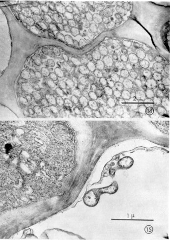 Fig. 4. Enfermedades del maz causada por virus ( 14 ) Corte horizontal de vasos conductores de plantas de maz con el achaparramiento. Se observa gran cantidad de estructuras correspondientes a espiroplasmas, 109 cuales son los organismos causantes de esta enfermedad. (15) Corte a travs de un vaso conductor de planta de maz con achaparramiento, en el cual se observa un espiroplasma en forma longitudinal.