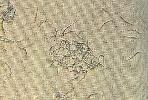 Fig. 7. Protozoarios aislados de cocoteros afectados por marchitez. Medidas 13,6  17,8 de largo y 1,1 - 2,1  de ancho (320x).