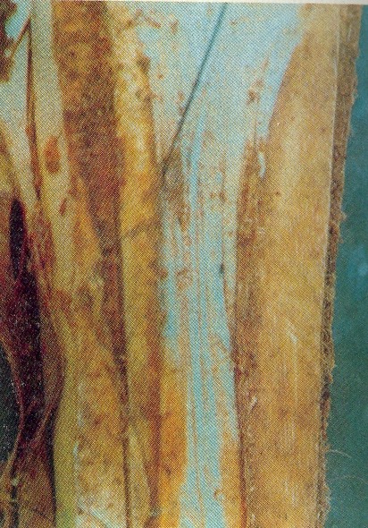 Fig. 6. La zona del corazn con los sntomas avanzados de la enfermedad presenta una pudricin con olor fetido. 