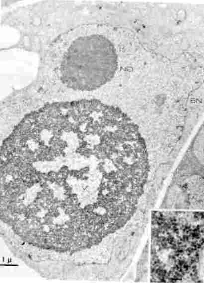 Fig. 5. Micrograf�a electr�nica de un corte ultrafino de tejido de papa 'Sebago' infectado con el VMAT. m�s, en dos de las siembras evaluadas no se detectaron plantas con s�ntomas, lo cual reafirma la baja difusi�n del fen�meno.