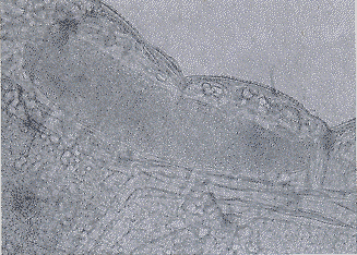 FIGURA 1. Huevo de E. vitticolle reci�n ovipositado dentro del hemocelo de una larva hospedera de cuatro d�as de edad.