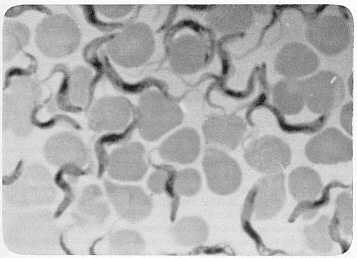 Fig. 1 Microfotografia da T. vivax (Capa Swain) en sangre de rata infectada. Aumento l00x.