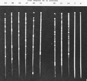 Fig. 4 Reacciones de aglutinacin capilar durante el curso de la infeccin con T. vivax (Cepas Suramericanas) en el becerro N 379