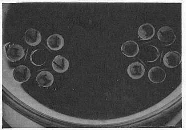 Figura 1. Inmunodifusin doble (Ouchterlony).