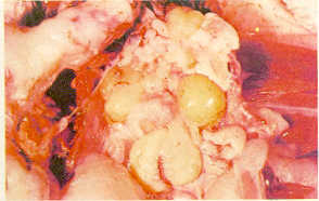 FIGURA 1.  vulos plidos, flcidos y hemorrgicos