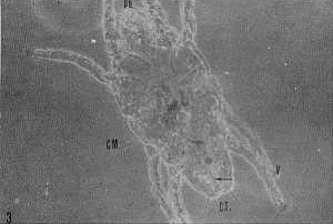 FIGURA 3. Dermatophagoides scheremetewskyi. Aspecto general de caro a 160X. Se observan las piezas bucales (pb), la cerda medial (CM), la ventosa (V) terminal en el pretarso de III par de patas y las 4 cerdas terminales (C, T) caractersticas de esta especie. La flecha seala la ubicacin  del ano.