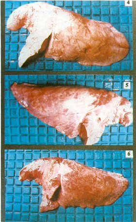 FIGURAS 4, 5 y 6.