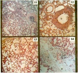 FIGURA 11. Grupo "A" muestra ala iudemuidad del parenquima pulmonar M. E. 120X.
