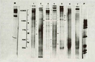 FIGURA 1.Patrones electroforticos de ADN de cepas de campo de pseudorrabia digeridos con PVU II. Carriles M y P: ADN de Fago digerido con Hind III y ADN Fago O x 174 digerido con R Hae III, respectivamente: Carriles 1 y6: Fragmentos ADN- PRV aislado A. Carril 2: Framentos ADN-PRV aislado B. Carril 3: Framentos ADN-PRV aislado C. Carril 4: Fragmentos ADN-PRVaislado D. Carril S: Framentos ADN-PRV aislado E. Carril 7: Framentos ADN-PRV aislado F .