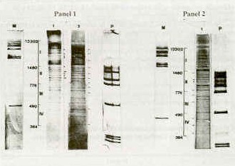 FIGURA 2.  Panel 1: Patrones electroforticos de ADN de cepas de campo de pseudorrabia digeridos con . PVU II. Carriles M y P: ADN de Fago digerido con Uind III y ADN Fago O x 174 digerido con Uae III, respectivamente: Carrill: Fragmentos ADN-PRV aislado G. Carril 2: Fragmentos ADN-PRVaislado U. Panel 2: Patrn electrofortico de ADN cepa Bartha digerido con PVU II. Carriles M y P: ADN de Fago Lambda digerido con Hind 111 y ADN Fago O x 174 digerido con Hae III.