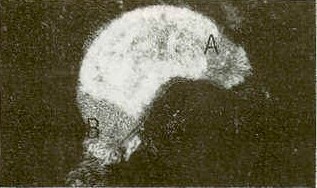 Figura 1a. Observacin en fresco de trematodo branquial, se destaca en la regin del pro-haptor 4 puntos oculares (A). En el opistohaptor, ganchos de fijacin (B). Aumento 80x.