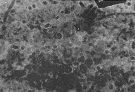 FIGURA 1. Oocisto de C. baileyi 2-6 um, granulos citoplasmaticas negruzcos. coloracion Kinyoun,100x