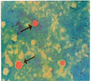 Figura. Ooscitos de Crytosporidium parvum. Coloracin Kinyoun 100X.