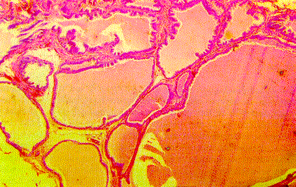 Figura 1. Vescula semina, coloracin Hematoxilinay Eosina, 10X.