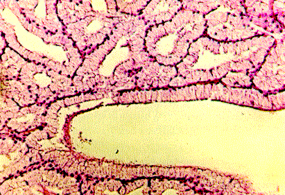 Figura 3. Glndula Bulbouretral (Cowper), coloracin Hematoxilina y Eosina, 63X.