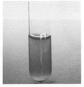 FIGURA 3. Crecimiento filamentoso de B. avium, en caldo infusin cerebro corazn.