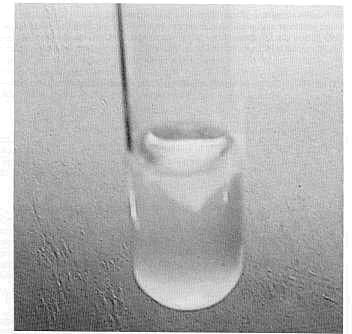 FIGURA 4. Crecimiento de B. avium, en caldo infusin de ternera, con pelcula en la superficie a las 48 horas.