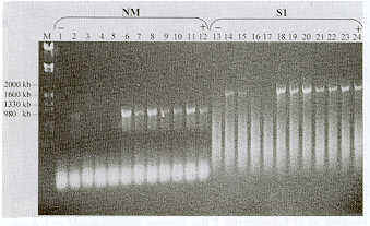 FIGURA 1. Electroforesis en un gel de agarosa mostrando el producto amplificado de ADN copiado de ARN, mediante RT-PCR extrado de fluido alantoideo de embriones infectados con BIA. Lnea M = Marcador de peso molecular (PCR Marker Sigma-AIdrich); lneas 1 y 13 = Control Negativo; lneas 12 y 24= Control Positivo; lneas 2-11= Producto de RT-PCR correspondiente al gen que codifica para la Protena NM; lneas 14-23 = Producto de RT-PCR correspondiente al gen que codifica la protena S1. Los nmeros en el lado izquierdo vertical representan los pesos en pares de kilo del marcador de peso molecular.