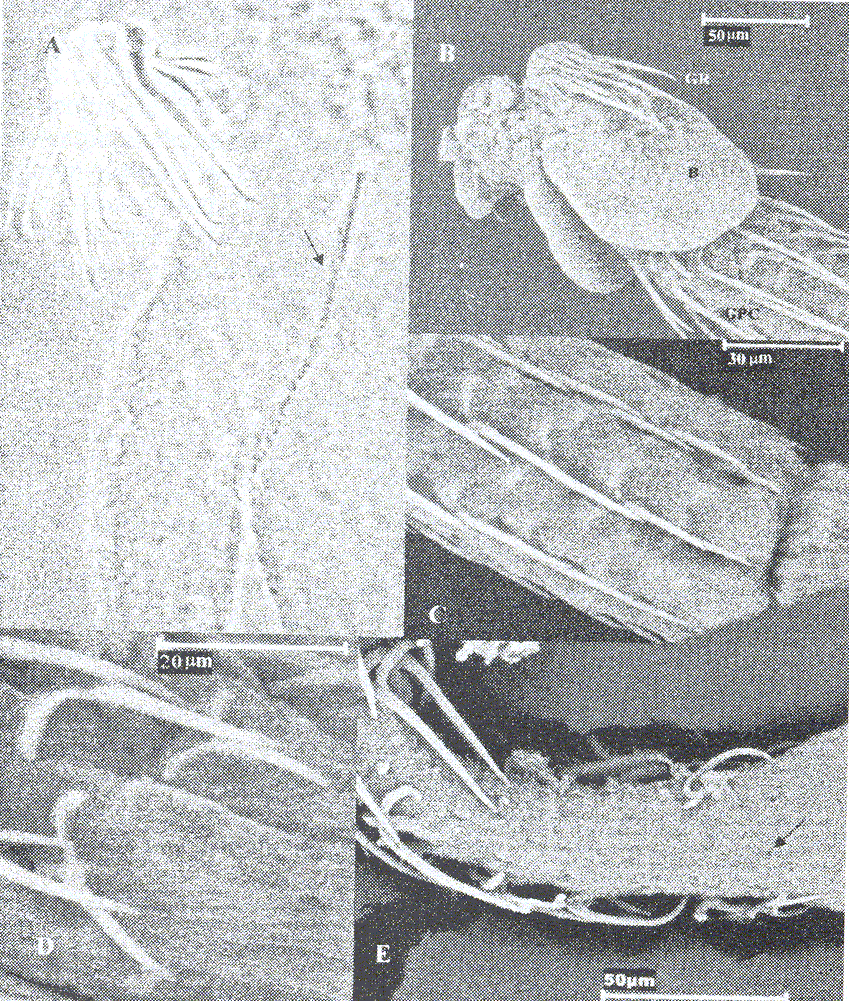 Figura 4. Echinobothrium brachysoma. A: Microscopa ptica del esclex, la flecha indica microtricos; B: Microscopa electrnica de barrido (SEM); GR: Ganchos del rostelo; GPC: Ganchos pednculo ceflico; b: Botrodio; C: Ganchos posteriores del pednculo ceflico; D: Morfologa de los ganchos del pednculo ceflico; E: Flecha indica orificio de enganche de los GPc.