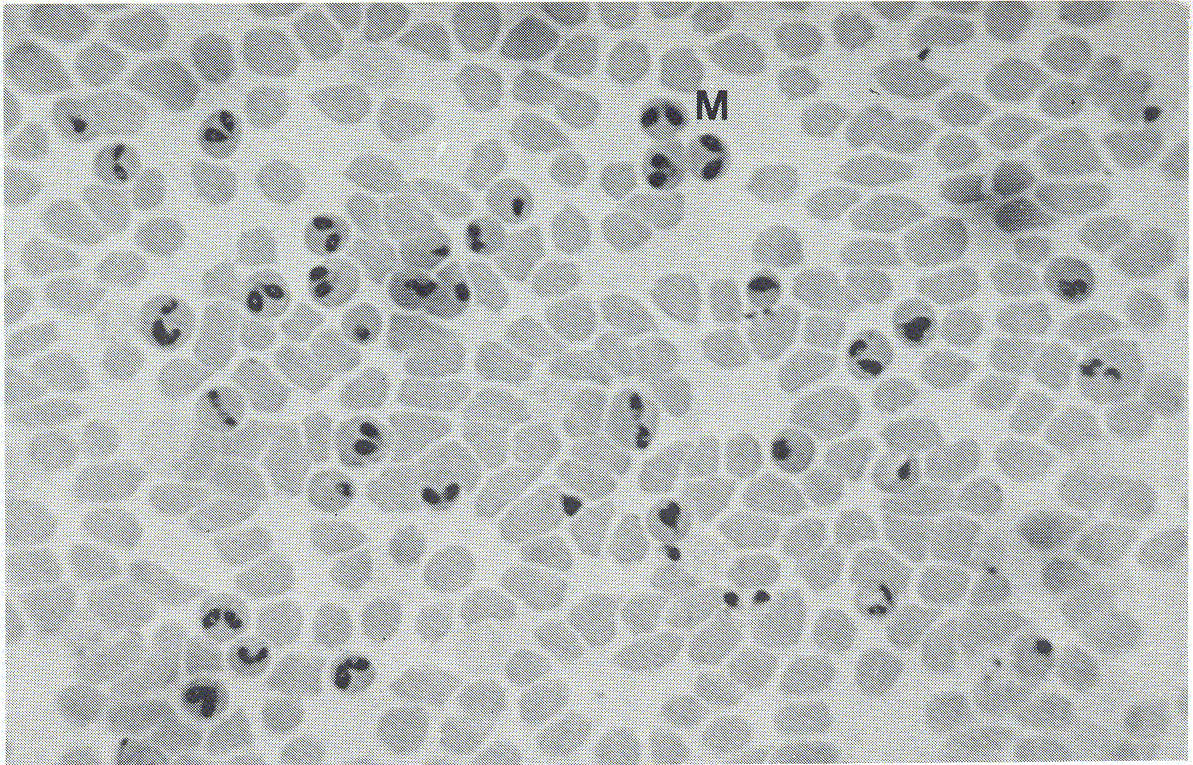 Morfologa de Babesia bovis. Los merozoitos (M) son la forma predominante. Giemsa. 1000X.