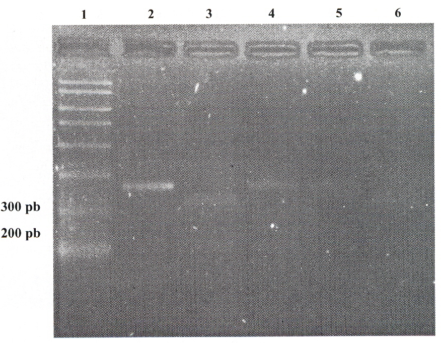 FIGURA 1. RFLP del P: 6792. Lnea 1: marcador Ladder de 100 pb; lnea 2: Dra I; lnea 3: Sac I; lnea 4: Sty I; lnea 5: Ssp I; lnea 6: Taq I.