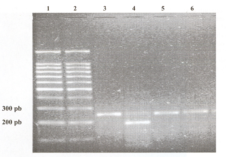 FIGURA 2. RFLP del P: 6 228. Lnea 1: marcador ladder 100 pb; lnea 2: Dra I; lnea 3: Sac I; lnea 4: Sty I; lnea 5: Ssp I; lnea 6: Taq I.