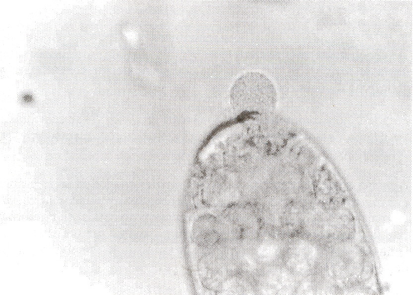 FIGURA. Aspectos, al microscopio de luz 100X, de la reaccin antigeno anticuerpo en la Prueba de Precipitacin Circumoval.