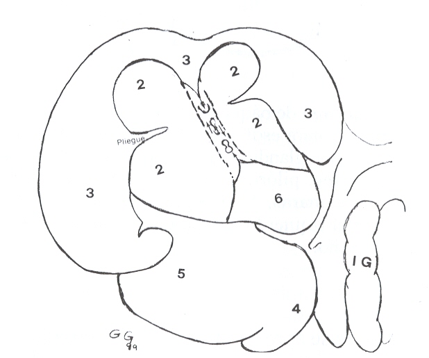 FIGURA 2. Estómago de báquiro, vista caudal. 2= región esofágica (compart. l); 3= región glandular (compart.II ); 4= reg. fúndica; 5= reg. pilórica; 6= reg. gland. compart. I; flechas= islote o banda que une mucosas 3 y 6. IG= intest. grueso.