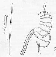 FIGURA 2. Camallanus Kachugae (Baylis y Daubney 1922). Regin vulvar de la hembra en vista lateral (De Baylis y Daubney)