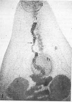 FIGURA 1. Platynosomun fastosum extremo anterior. Note su forma lanceolada. e. Esfago; c.i. Ciegos intestinales, u. tero; t. Testculos, v.b. Ventosa bucal; v.v Ventosa ventral. La flecha seala huevos en el tracto uterino. Luz ordinaria, 40 aumentos.
