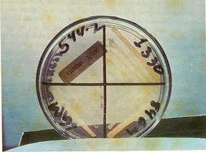 Fig. 1: Prueba de sensibilidad a colorantes