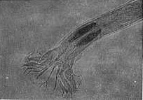 Fig. 1. Extremidad posterior del macho mostrando bolsa copuladora con sus espculas.