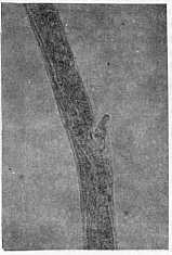 Fig. 3. especmen hembra. Regin vulvar mostrando el labio.