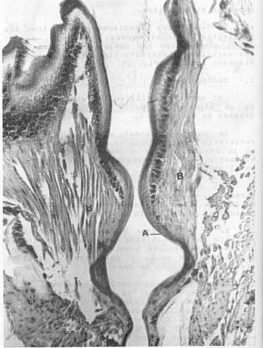 Fig. 3. Esófago Proventrículo. 256X. A-epitelio esofágico; B- capa muscular (f. longitudinales-H y E).