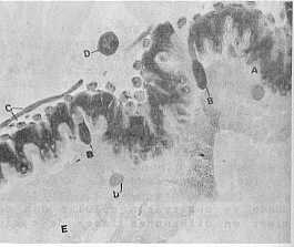 Fig. 5. Estomago 256X. Región fundica. A-epitelio estomacal; B-célula de lisis; C-fibras musculares; D- túbulos de malphigi; E. membrana peritrófica (H y E).