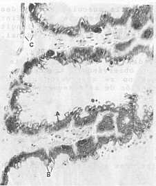 Fig. 4. Estomago 256X. Primera porción . A- epitelio estomacal cilíndrico simple; B- células de secrecion; C- fibras musculares (H y E).