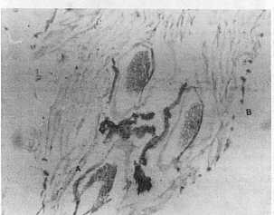 Fig. 7a Intestino grueso o cloaca .256X  A-bolsa cloacal; B-luz del rgano (H y B)